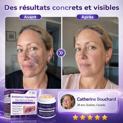 【110 𝒌+ 𝒗𝒆𝒏𝒅𝒖𝒔】🐣🐣𝑮𝒂𝒇𝒂𝒄𝒆® 𝑪𝒓è𝒎𝒆 𝒓é𝒑𝒂𝒓𝒂𝒕𝒓𝒊𝒄𝒆 𝒅𝒆𝒔 𝒆𝒄𝒄𝒉𝒚𝒎𝒐𝒔𝒆𝒔 𝒆𝒕 𝒇𝒐𝒓𝒕𝒊𝒇𝒊𝒂𝒏𝒕𝒆 𝒑𝒐𝒖𝒓 𝒍𝒂 𝒑𝒆𝒂𝒖